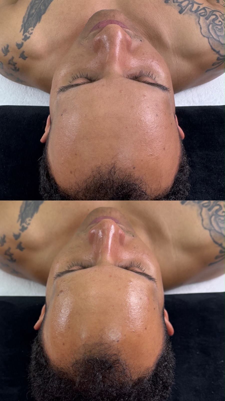 Antes y después de un tratamiento facial en Arisa Skin Studio